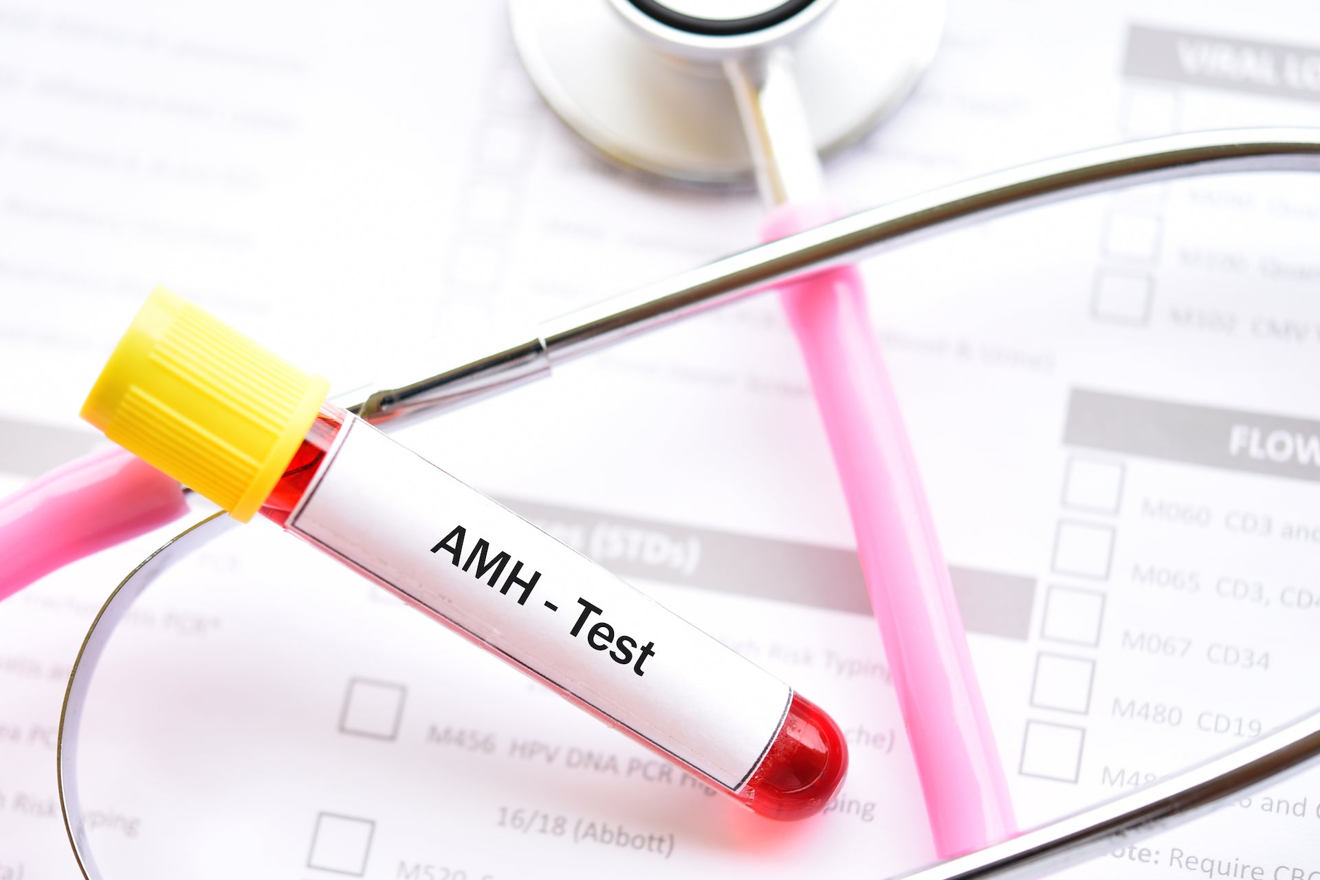 Anti-Mullerian Hormone (AMH): Role In Fertility, Levels And Tests ...