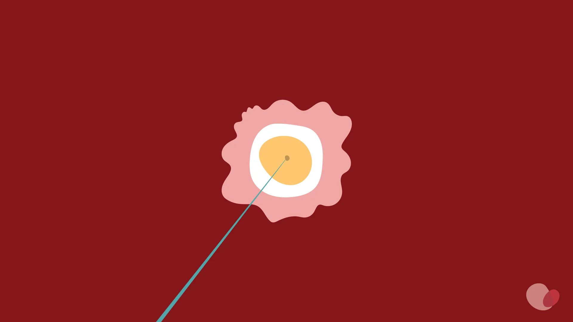 an oocyte retrieval needle retrieves an egg from the uterus